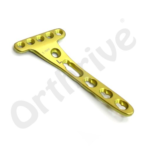 2.4mm Locking Volar Distal Radius Plate (5 Head Holes) Juxta Articular - SS/TT