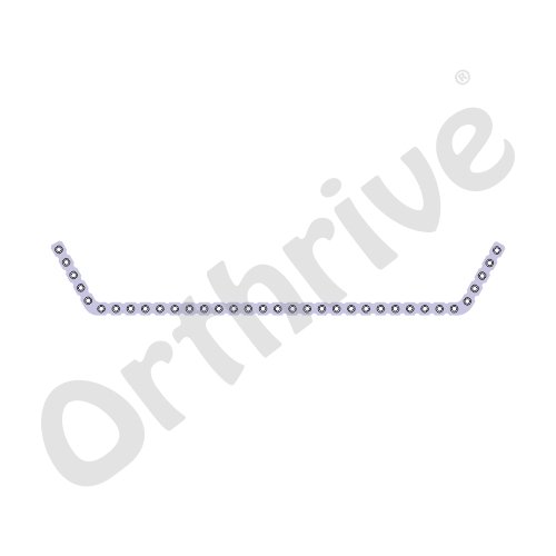 150° Double Angled Plate 2.7mm-(Round Holes)-SS/TT