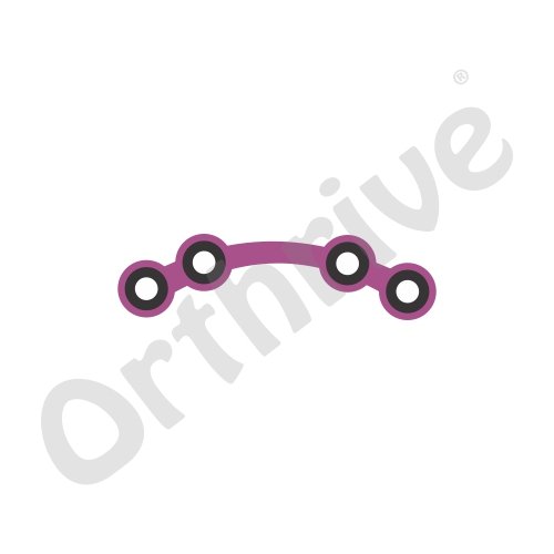 Locking Orbital Plate with Bridge-TT