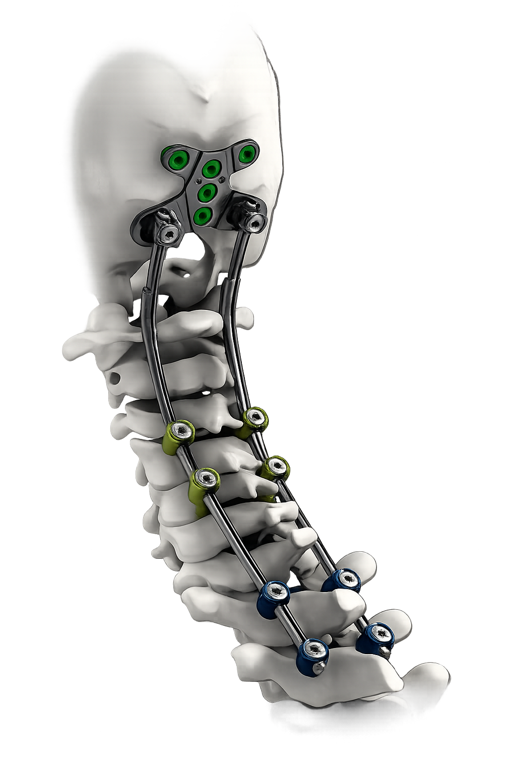 Orthopedic implant hero illustration